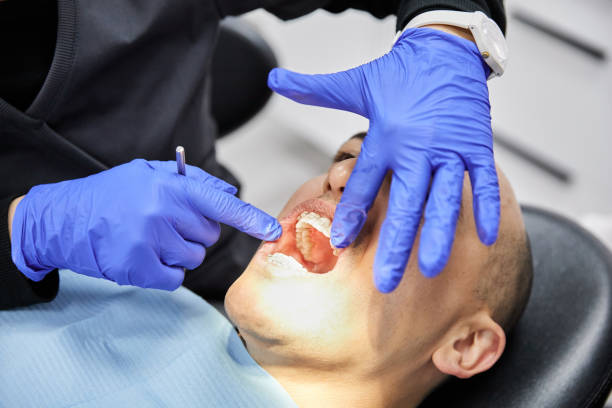 Best Emergency Root Canal Treatment in Brooklyn Park, MN